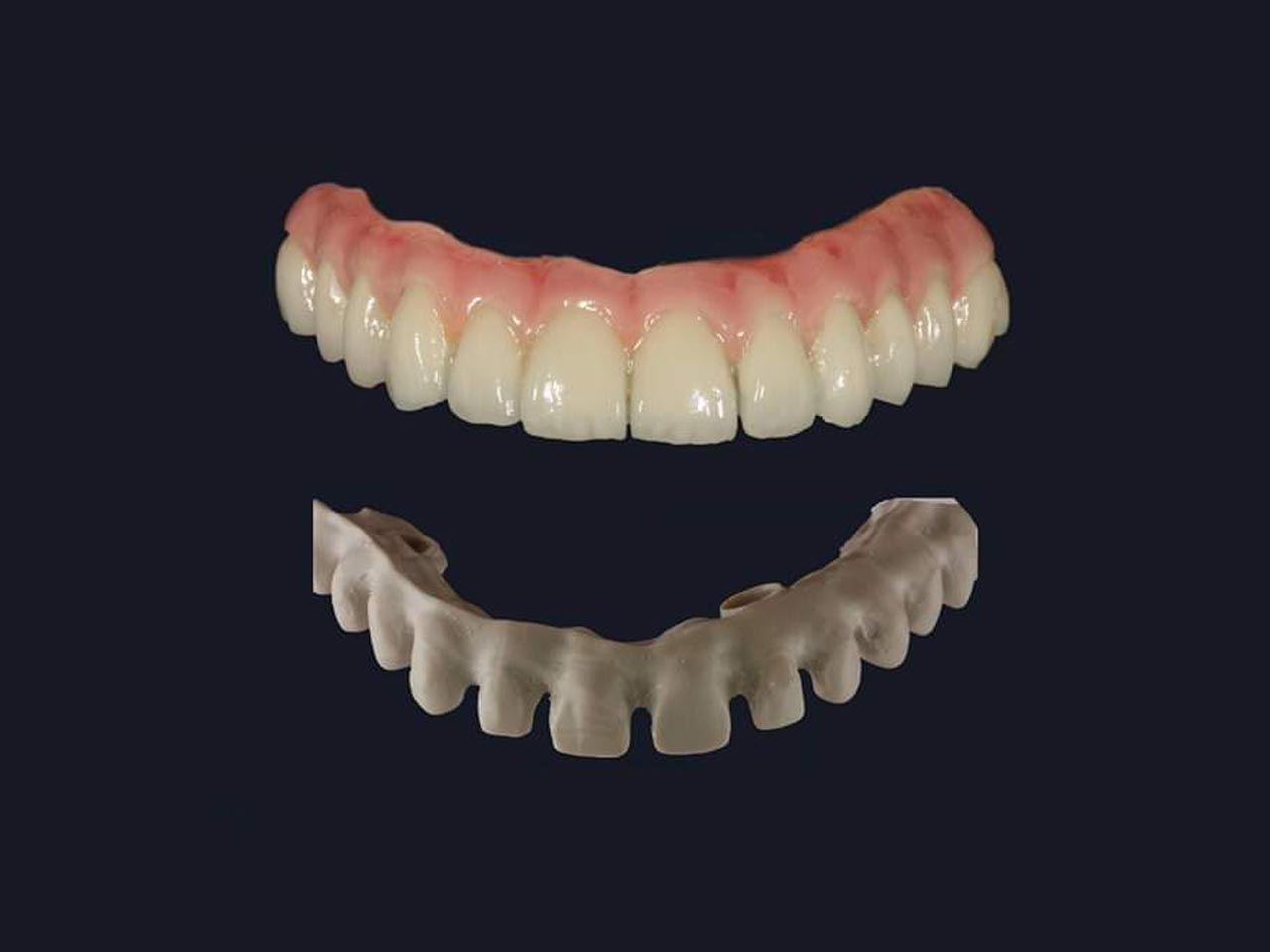 Implant Solutions Pink City